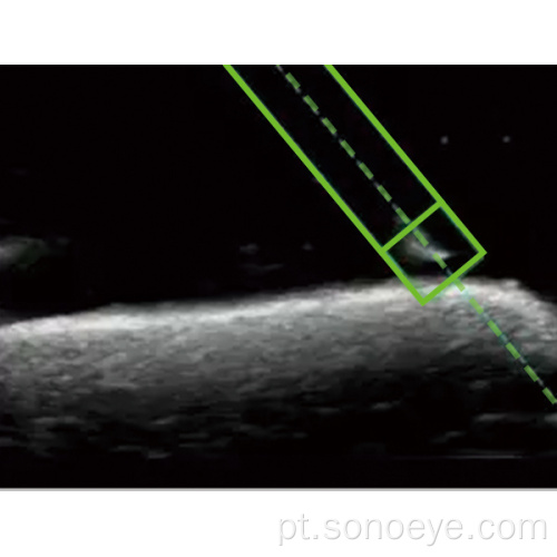 Cor Linear Color Doppler Ultrassonom Scanner